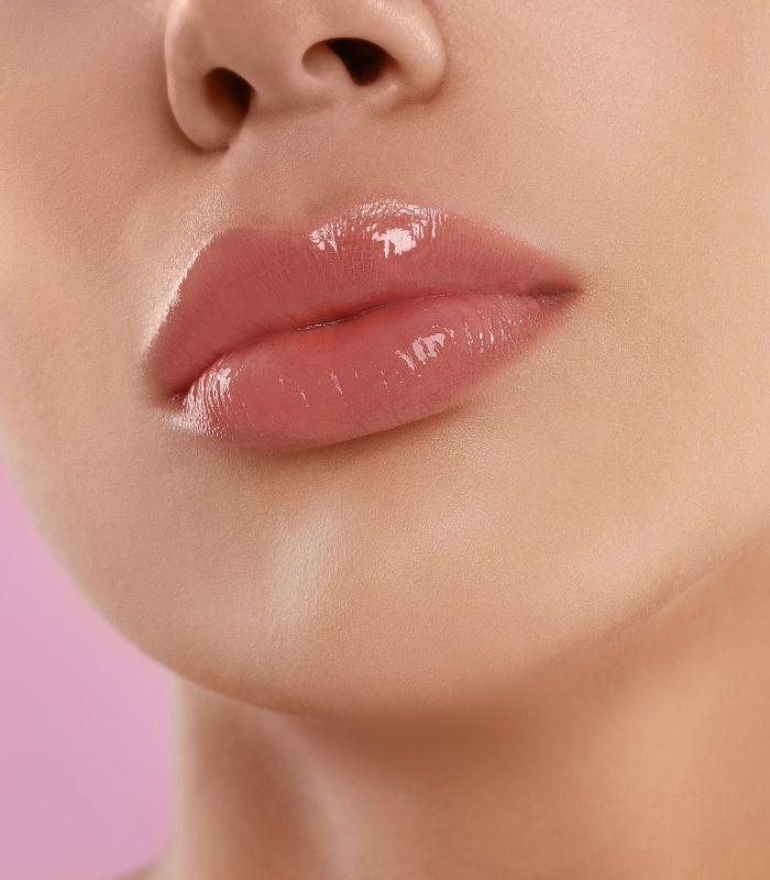 Lip Filler Injection