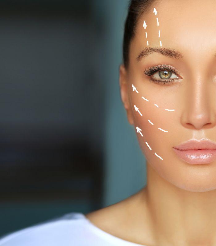 Thread Lift Consultation