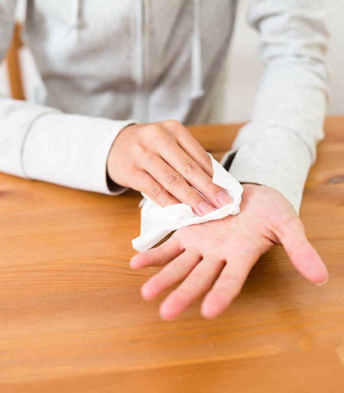 Hyperhidrosis Consultation